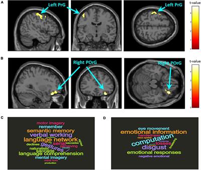 Association of Epigenetic Differences Screened in a Few Cases of Monozygotic Twins Discordant for Attention-Deficit Hyperactivity Disorder With Brain Structures